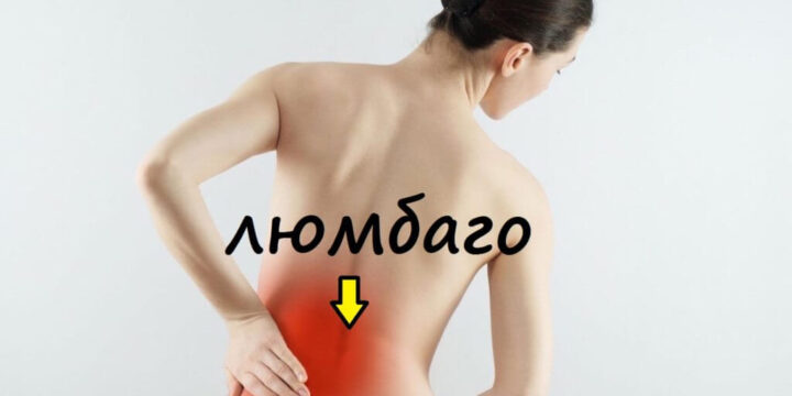 Люмбаго