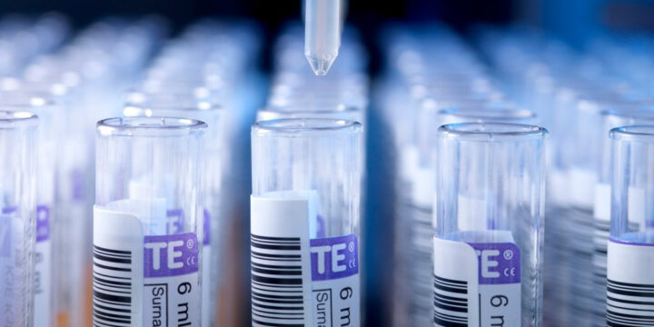 Згадаймо коротко про діагностику гепатитів!