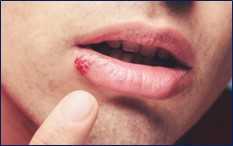 Сезонні захворювання та їх профілактика