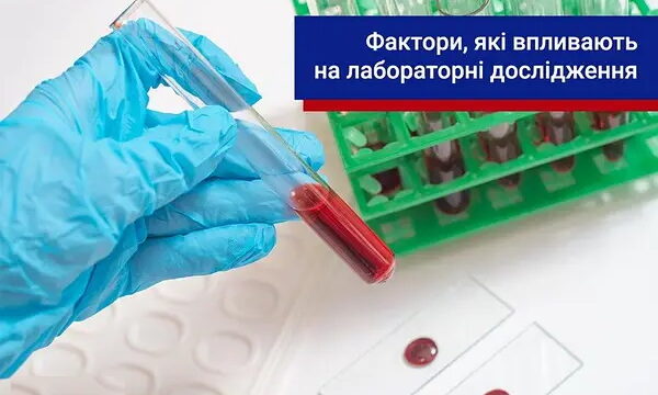 ТОП-5 несподіваних факторів, що впливають на лабораторні результати